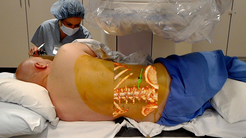 Image: A patient undergoing an APLD procedure with the help of OpenSight augmented reality technology (Photo courtesy of Novorad).