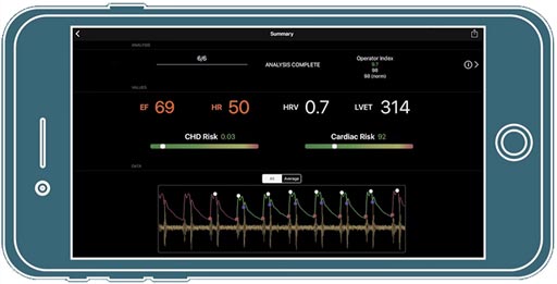 Image: A new study has shown that a new smartphone app, together with the phone’s camera, can be used to effectively measure blood-flow pressure waveforms in the CV system (Photo courtesy of RD Mag).