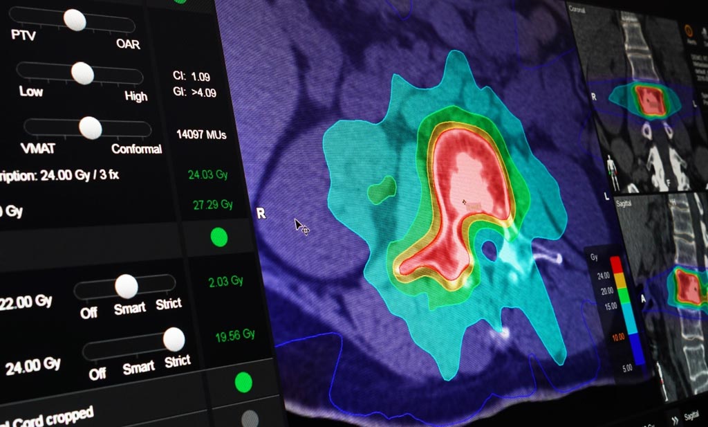 Image: New applications offer consistent and highly automated SRS planning (Photo courtesy of Brainlab).