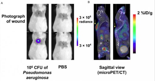 Image: Mice with a P. aeruginosa-infected wound (left) and control mice (right), and sagittal slices from a micro PET/CT scan one hour after administration of the new tracer (Photo courtesy of Sam Gambhir, MD, PhD, Stanford University).