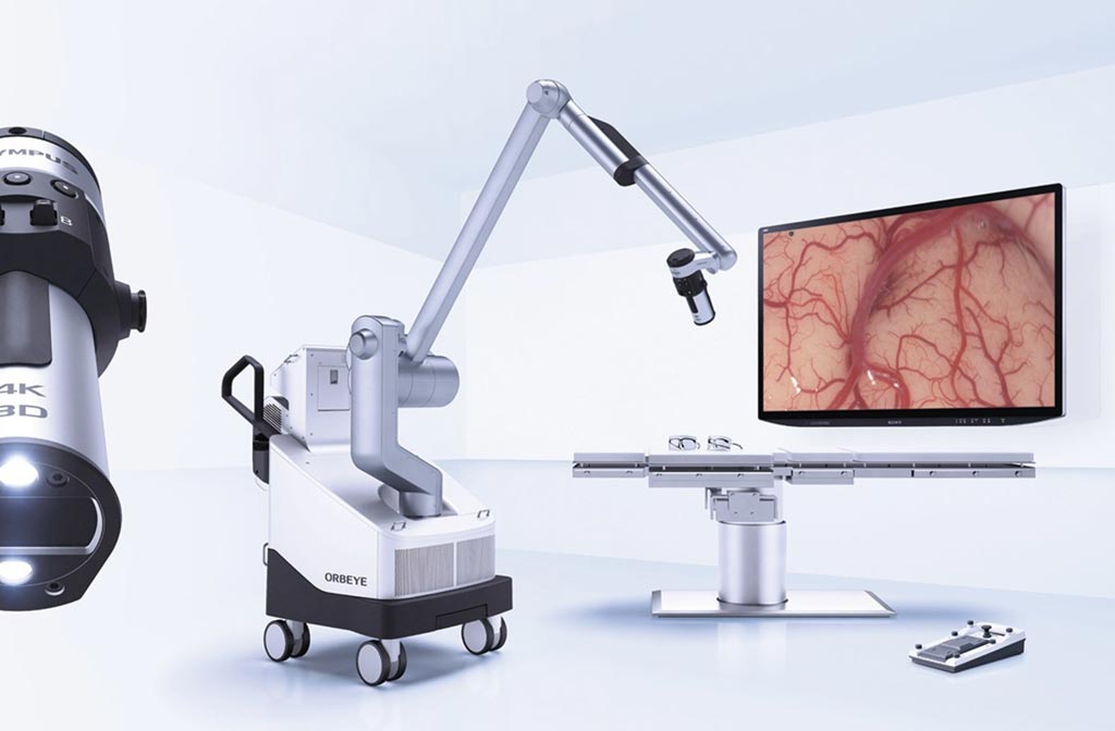 Image: The ORBEYE 4K-3D video microscope system (Photo courtesy of Olympus).