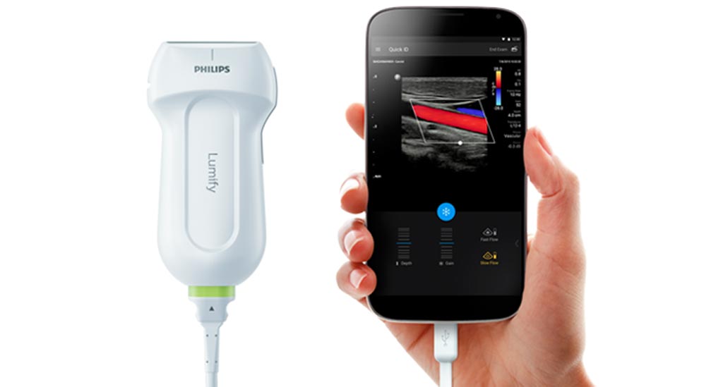 Image: The Lumify system is designed as a high-quality portable ultrasound (Photo courtesy of Philips Healthcare).
