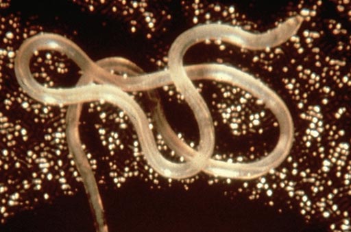 Image: An adult Loa loa worm (Photo courtesy of UC Berkeley).