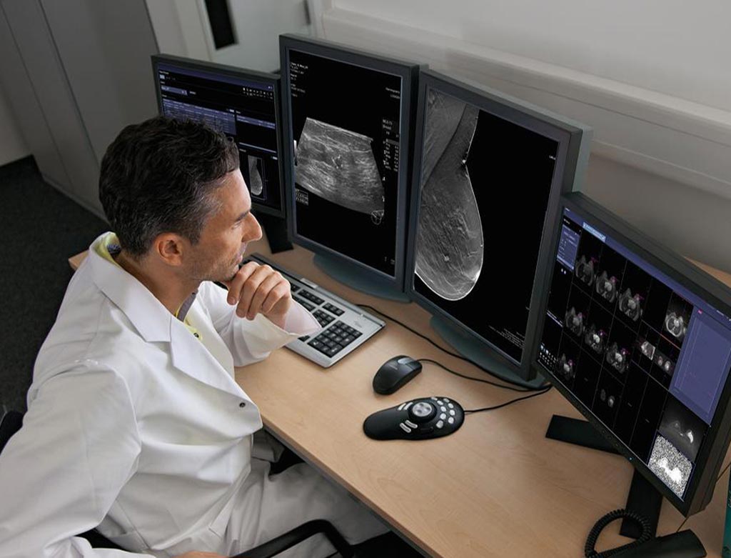 Image: The syngo.Breast Care workstation (Photo courtesy of Siemens Healthineers).