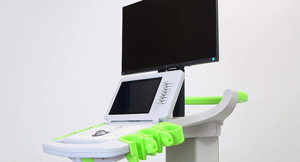 Image: The ExactVu micro-ultrasound system (Photo courtesy of Exact Imaging).