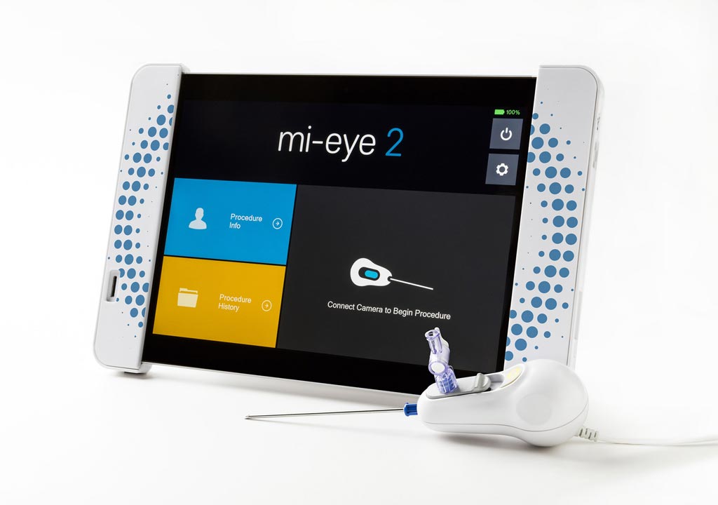 Image: The Mi-Eye 2 handheld visualization device and dedicated HD tablet (Photo courtesy of Trice Medical).