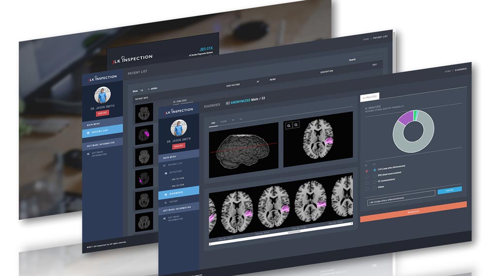 Image: JLK Inspection has developed an AI-based platform designed to assist doctors in quickly classifying the cause of a stroke (Photo courtesy of JLK Inspection).