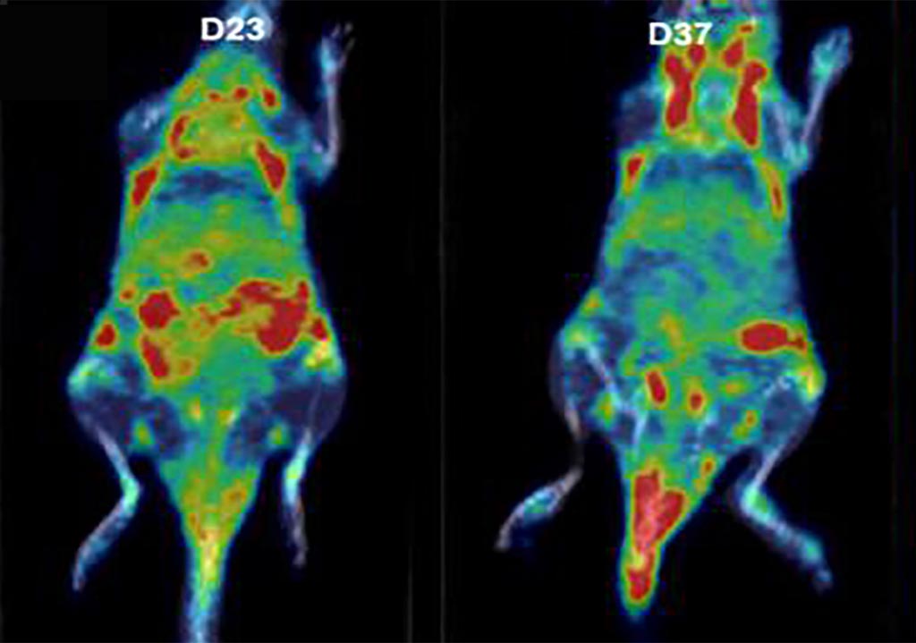 Image: Increased 18F-FEDAC as seen on PET/CT (Photo courtesy of SNU).