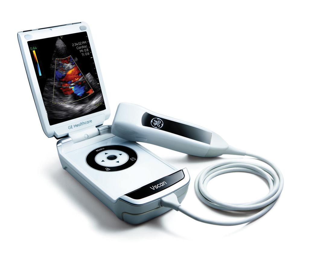 Image: The Vscan portable ultrasound (Photo courtesy of GE Healthcare).