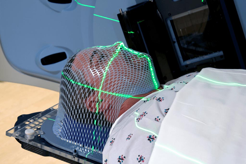 Image: A new protective agent reduces severe inflammation in the oral cavity following RT (Photo courtesy of iStock).