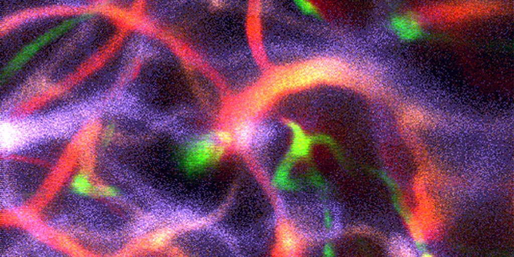 Image: Brain vasculature in an anaesthetized mouse captured using Pysight (Photo courtesy of Pablo Blinder/ TAU).