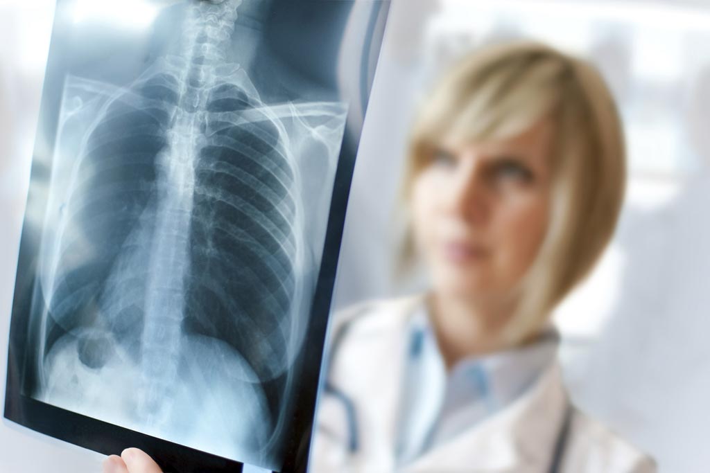 Image: A new study claims chest x-rays can help limit antibiotic therapy in suspected pneumonia (Photo courtesy of Alami).