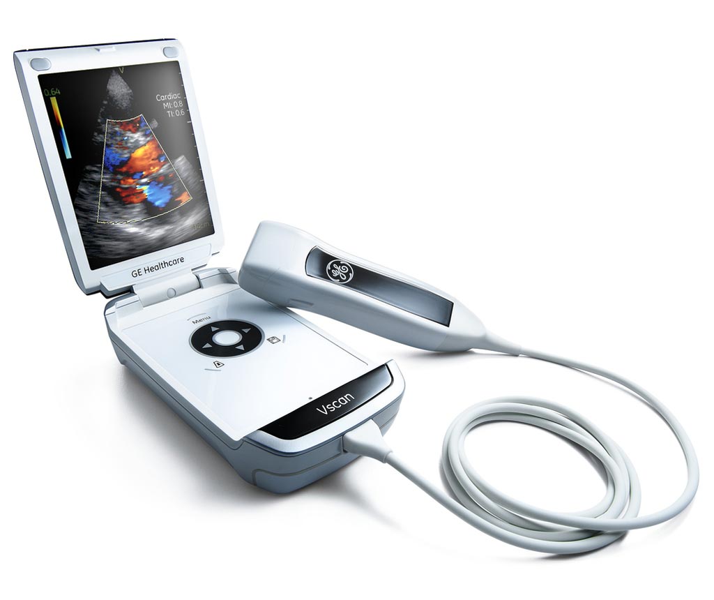 Image: The vScan handheld ultrasound device (Photo courtesy of GE Healthcare).
