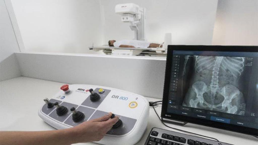 Image: The MUSICA Acquisition Workstation together with the DR800 system (Photo courtesy of Agfa HealthCare).