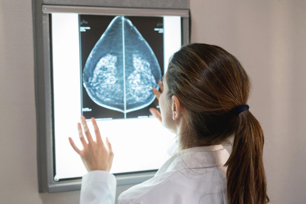Image: An artificial intelligence algorithm can detect dense breast tissue (Photo courtesy of MIT).
