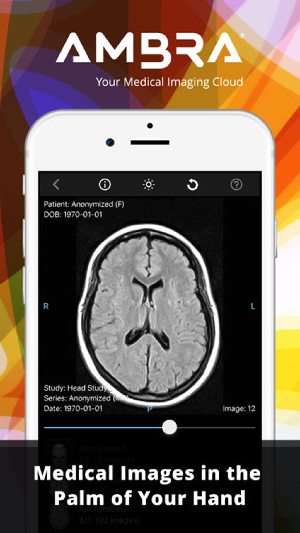 Image: A new app allows medical images to be viewed on an iPhone (Photo courtesy of Ambra Health).