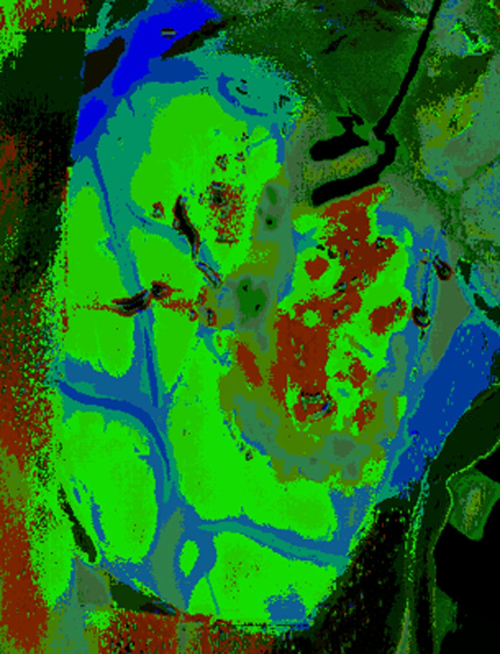 Image: Hyperspectral image of the brain; the tumor is indicated by red pixels (Photo courtesy of HELICoiD project).