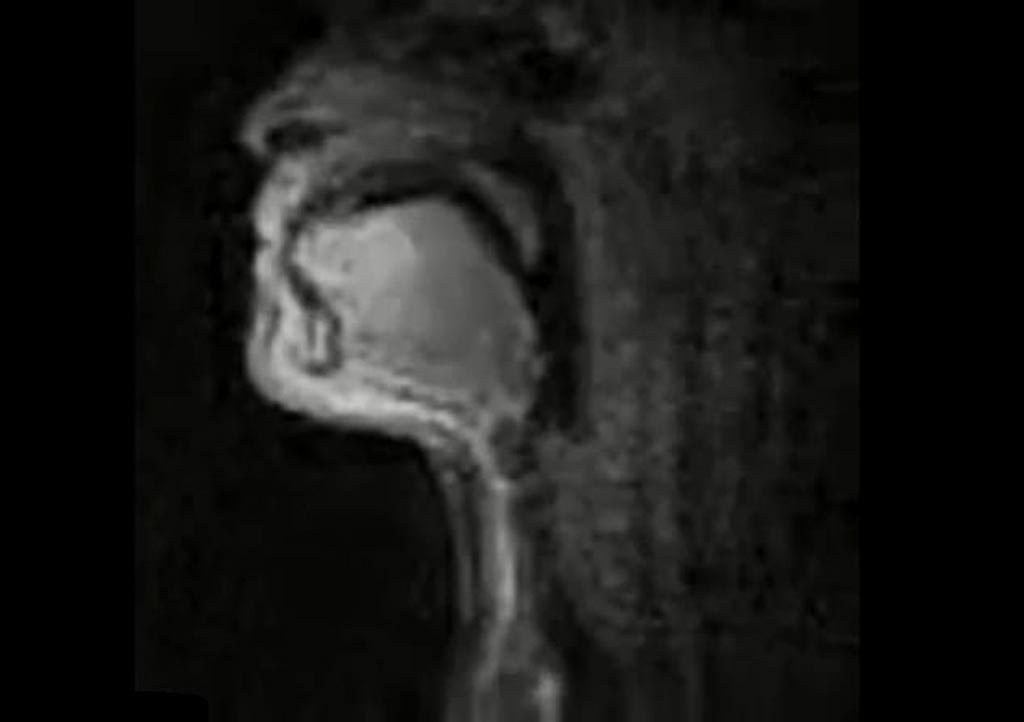 Image: Real-time MRI shows how vocal chords move to create beatbox sounds (Photo courtesy of Timothy Greer/ UC Berkeley).