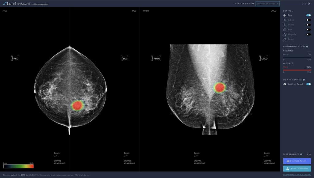 Image: The Lunit INSIGHT for Mammography is expected to increase the cancer detection rate of radiologists by 10% when used as a second reader (Photo courtesy of Lunit).