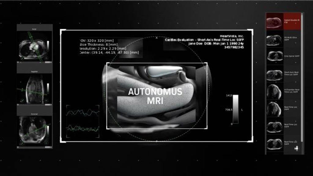 Image: An AI-driven solution facilitates cardiac MRI scans (Photo courtesy of HeartVista).