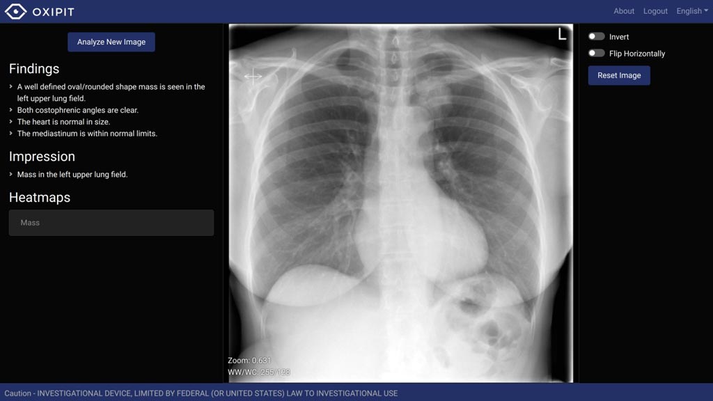 Image: A screenshot from the ChestEye radiology imaging suite (Photo courtesy of Oxipit).