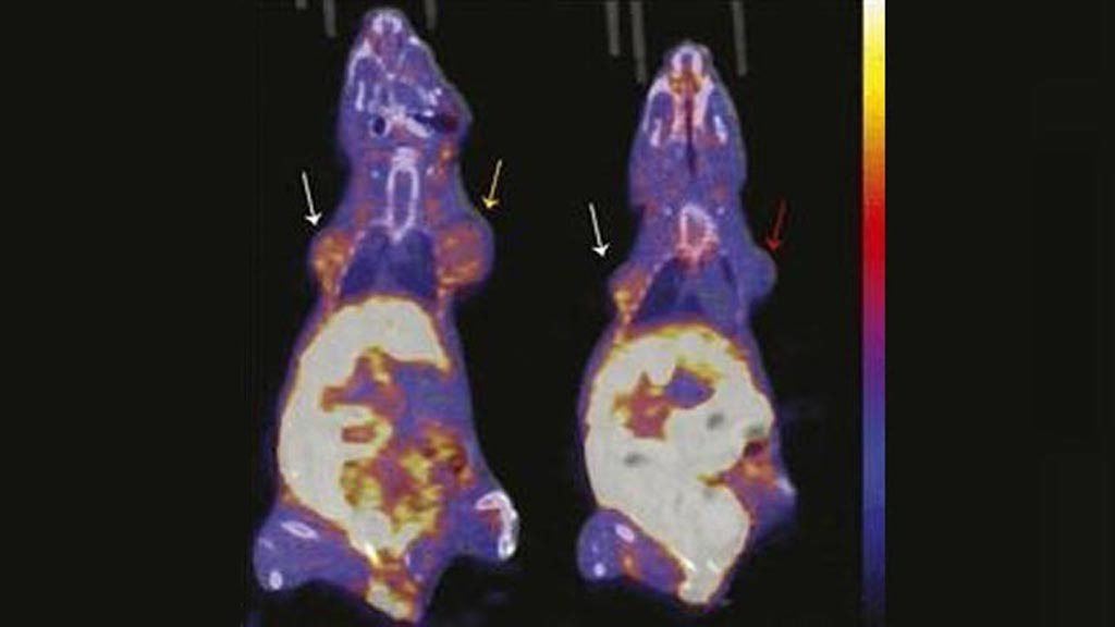 Image: Representative images of coronal 18F-FFNP uptake on PET/CT (Photo courtesy of UWHealth).