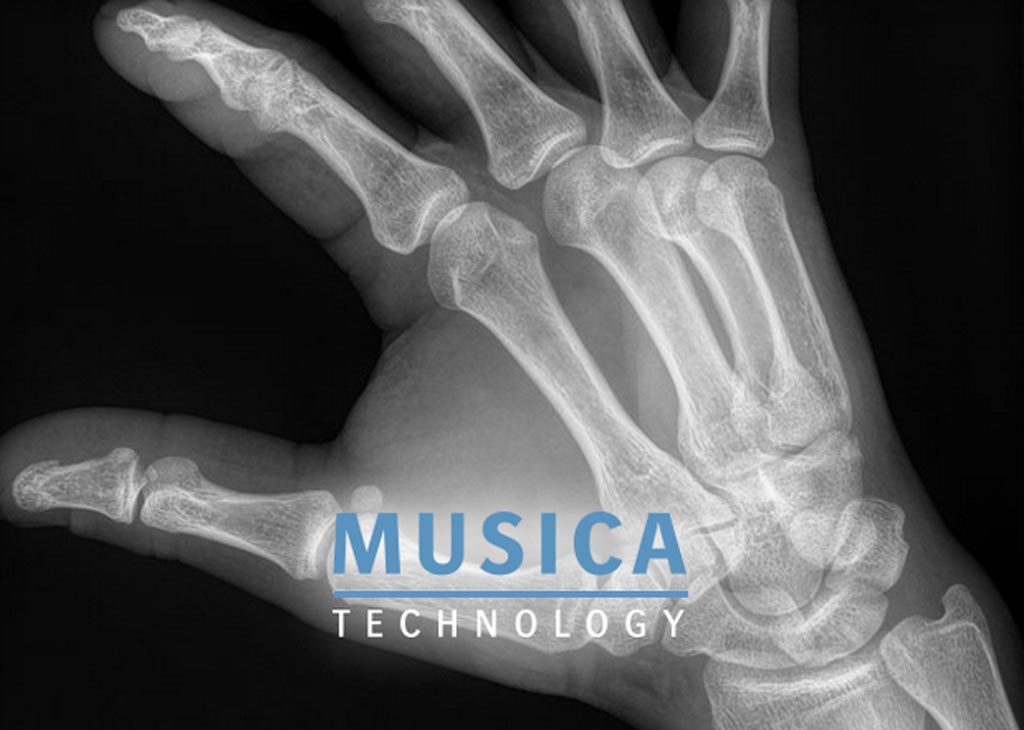 Image: The MUSICA platform is designed to enable workflow efficiencies and clinical collaboration (Photo courtesy of Agfa HealthCare).