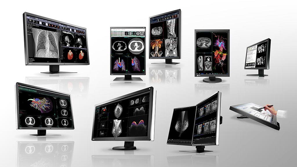 Image: Various monitors for radiology diagnostic solutions (Photo courtesy of EIZO).