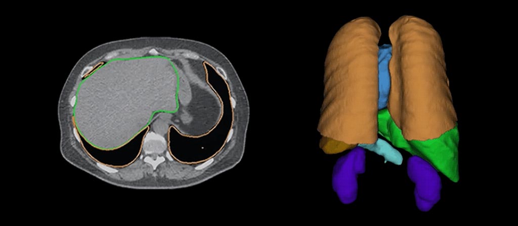 Image: With REiLI, Fujifilm is developing a technology to accurately recognize and consistently extract organ regions, regardless of deviations in shape, presence or absence of disease, and imaging conditions (Photo courtesy of Fujifilm Medical Systems).