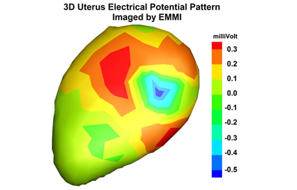 Image: EMMI mapping of uterine contractions (Photo courtesy of WUSTL).