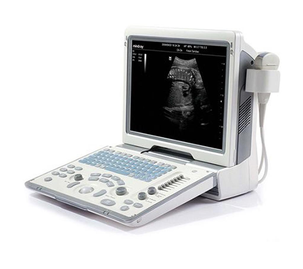 Image: The DP-50 portable ultrasound (Photo courtesy of Mindray).
