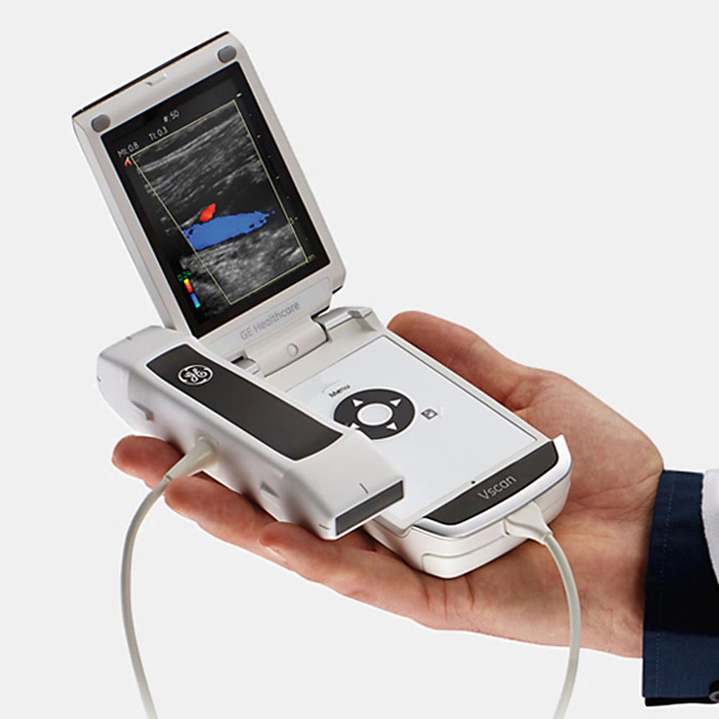 Image: The Vscan portable handheld ultrasound (Photo courtesy of GE Healthcare).