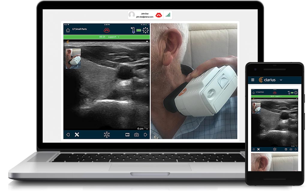Image: The Clarius Live app allows ultrasound scan sharing (Photo courtesy of Clarius MobileHealth).