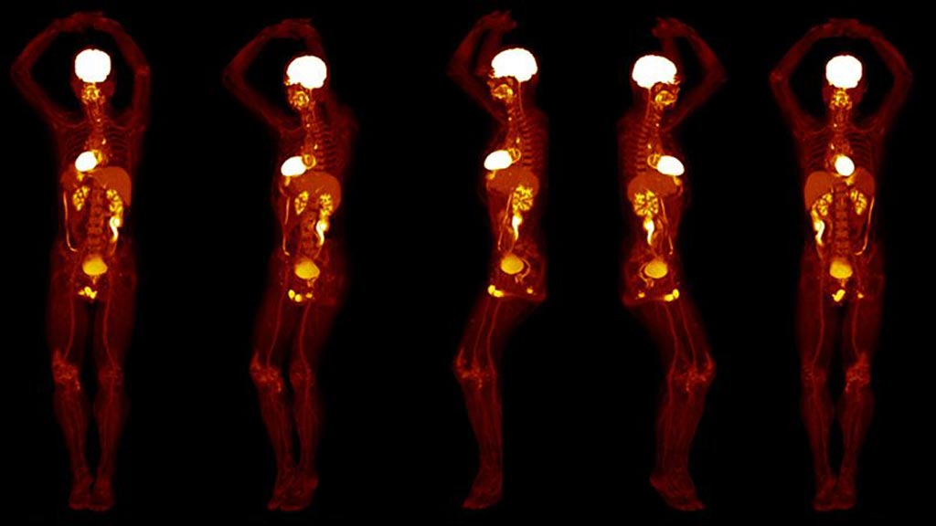 Image: Whole-body PET scans can now be done in 20 seconds (Photo courtesy of UCD).