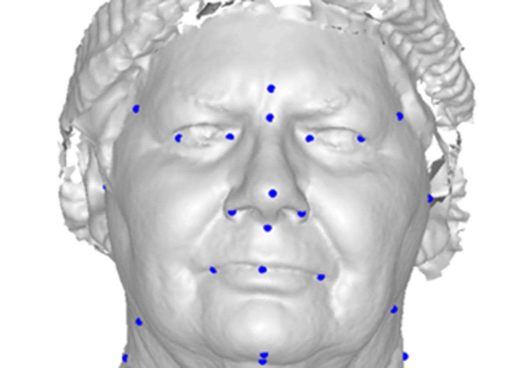 Image: A new study claims 3D facial photography can predict OSA (Photo courtesy of UWA).