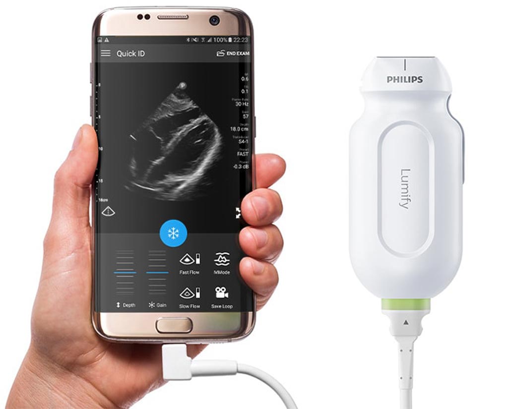 Image: The Lumify handheld ultrasound scanner (Photo courtesy of Philips Healthcare).
