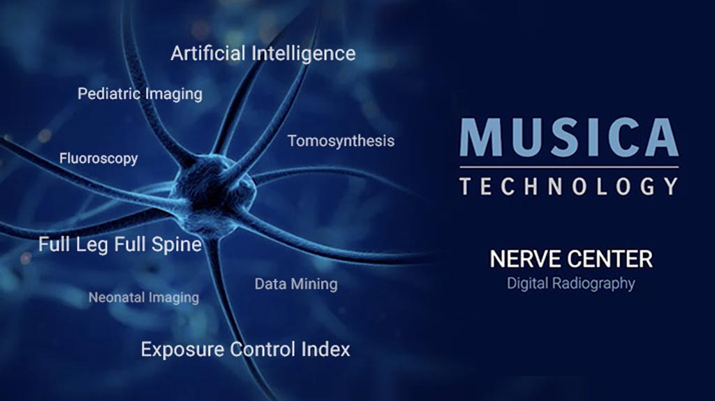 Image: The MUSICA Nerve Center offers customer-driven workflow and powerful, innovative features (Photo courtesy of Agfa HealthCare).