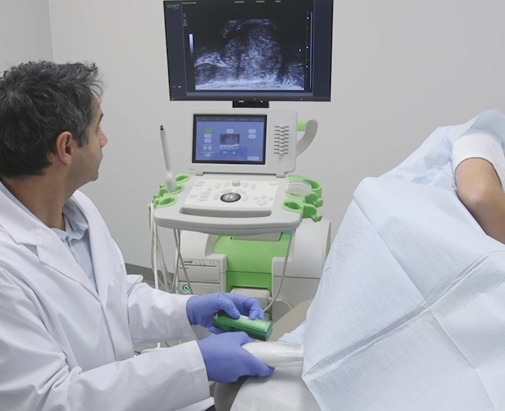 Image: The 29 MHz micro-ultrasound increases diagnostic accuracy (Photo courtesy of Exact Imaging).