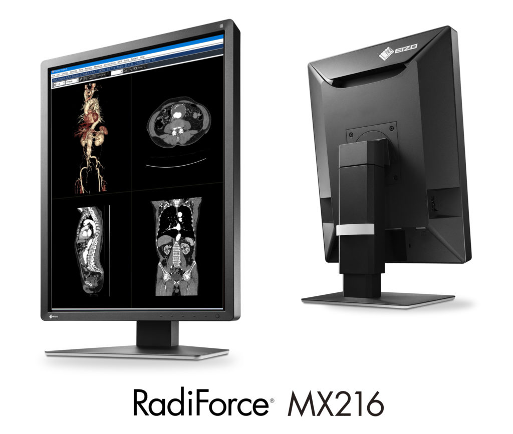 Image: The RadiForce MX216 two megapixel monitor (Photo courtesy of EIZO)