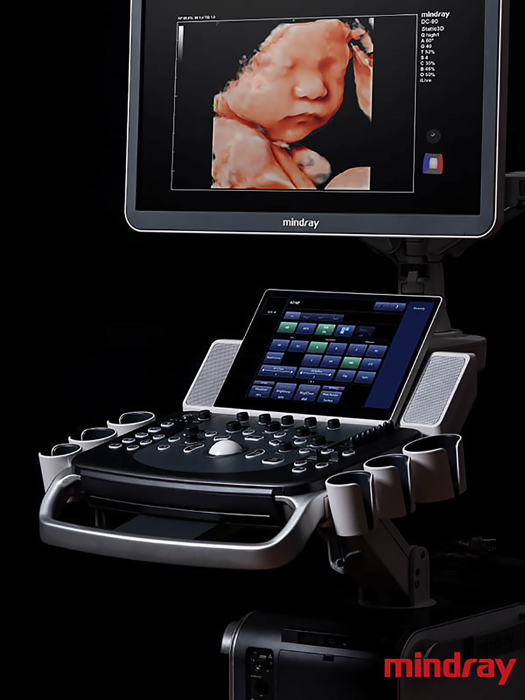 Image: The DC-90 Ultrasound System with X-Insight (Photo courtesy of Mindray)