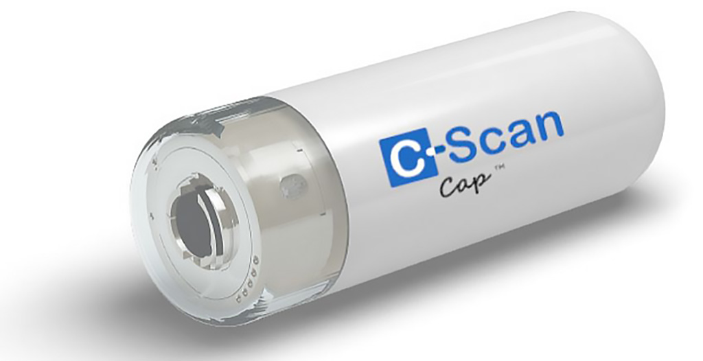 Image: The Check-Cap prepless disposable capsule (Photo courtesy of Check-Cap)