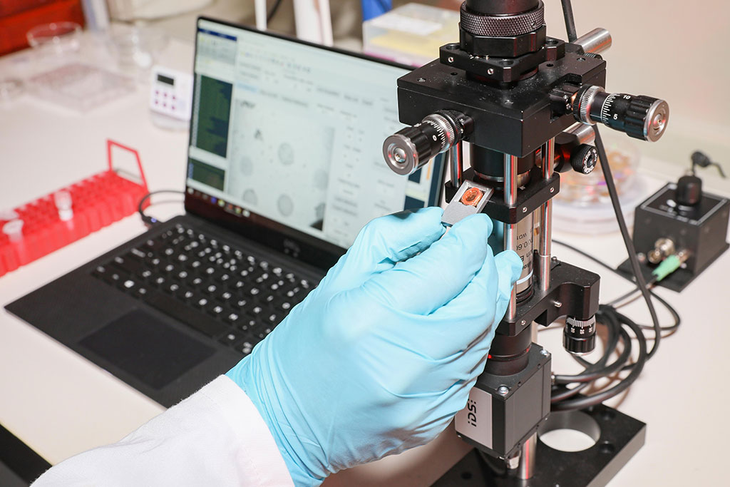Image: A nano-scale optical biosensor can rapidly detect sepsis (Photo courtesy of EPFL)