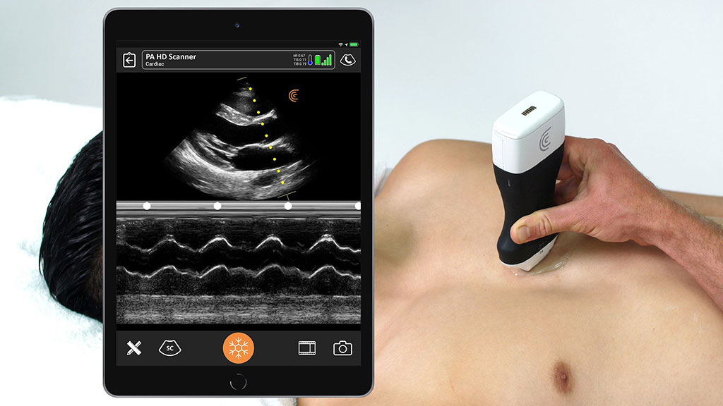 Image: The Clarius PA HD ultrasound scanner aids rapid point of care exams (Photo courtesy of Clarius)