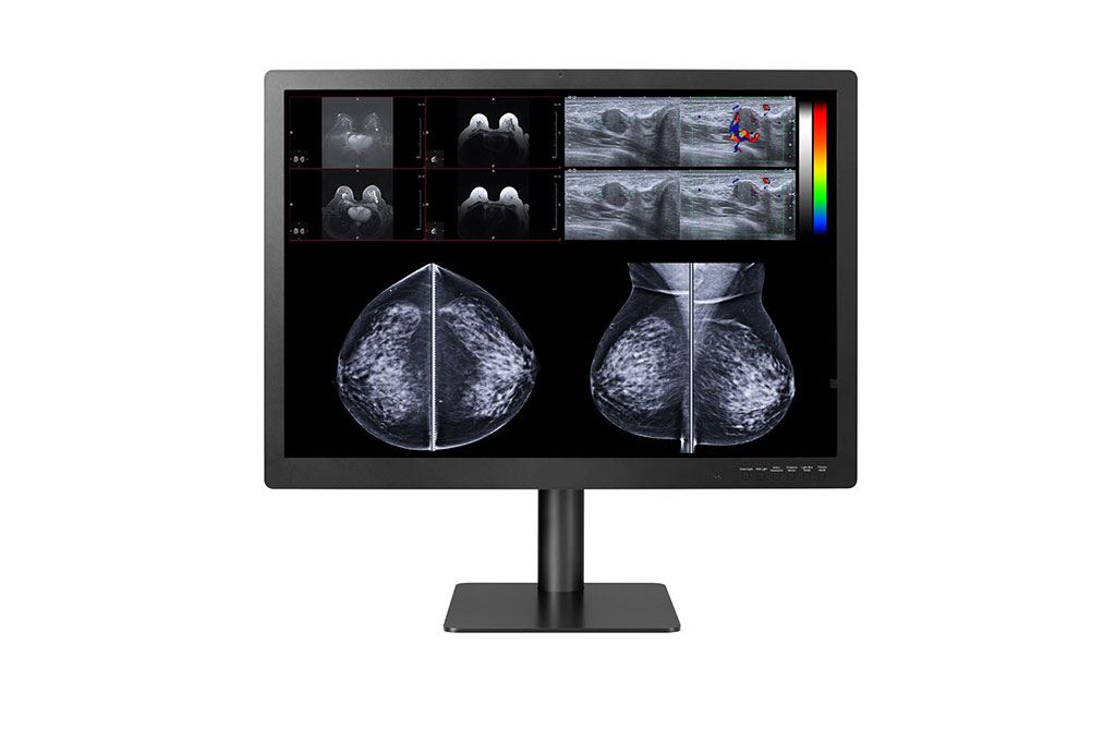 Image: The Gemini 12MP Expands breast imaging and PACS display solutions (Photo courtesy of DBI)