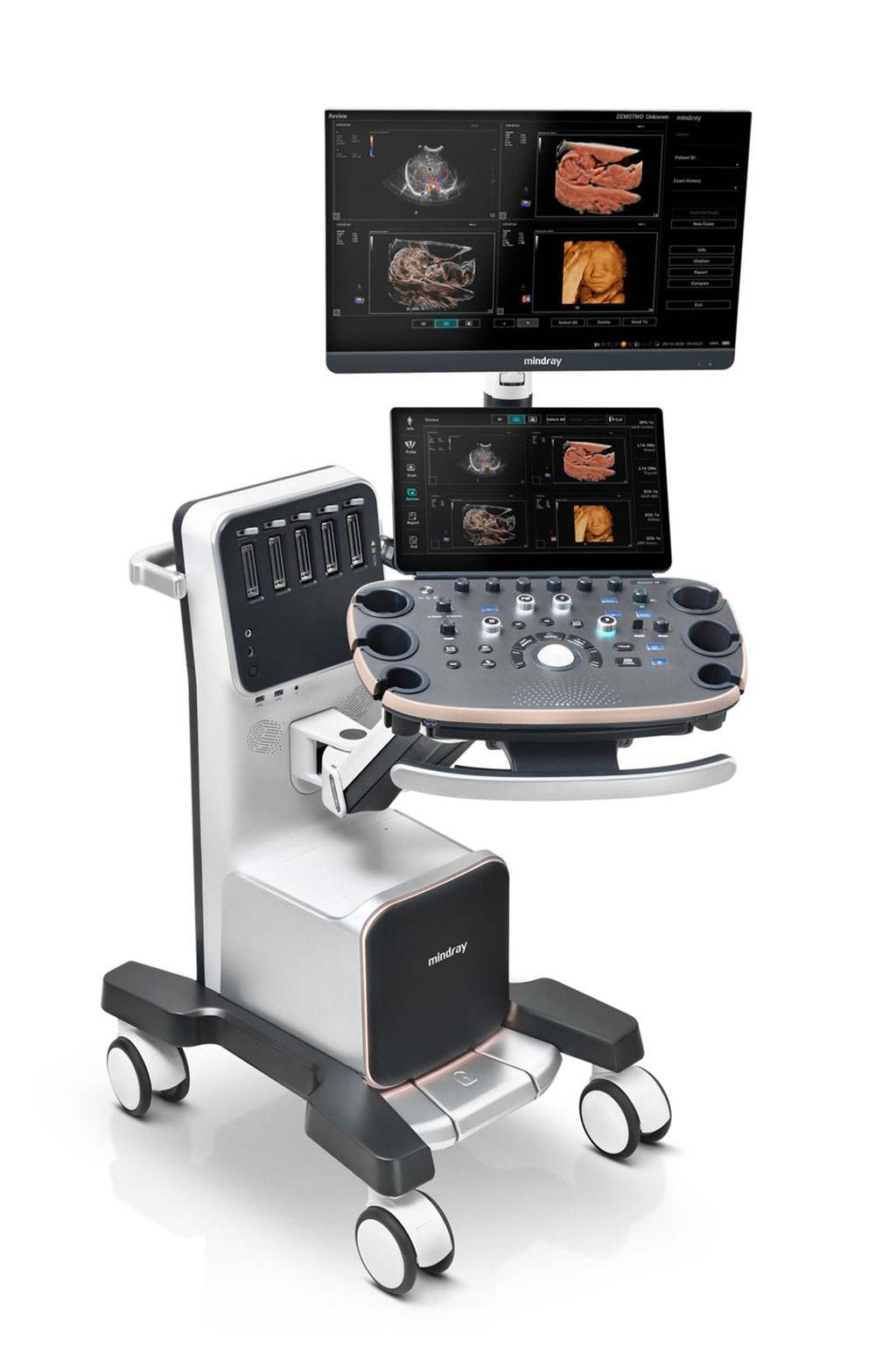 Image: The Nuewa I9 OB/GYN ultrasound system (Photo courtesy of Mindray)