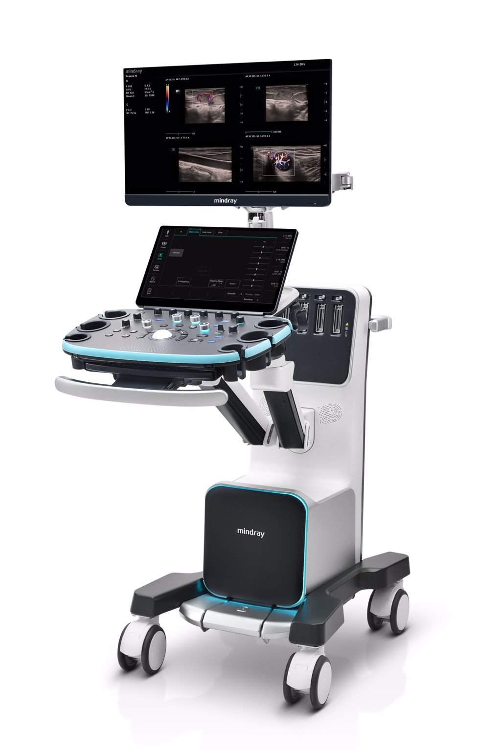 Image: The Resona I9 Ultrasound System (Photo courtesy of Mindray Medical)