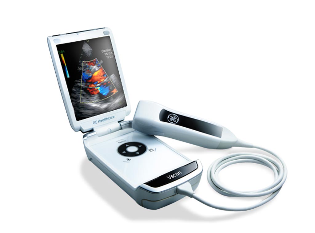 Image: The vScan handheld ultrasound device (Photo courtesy of GE Healthcare)