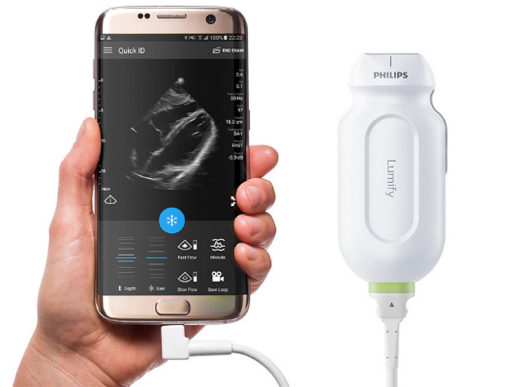 Image: Lumify handheld ultrasound (Photo courtesy of Royal Philips)