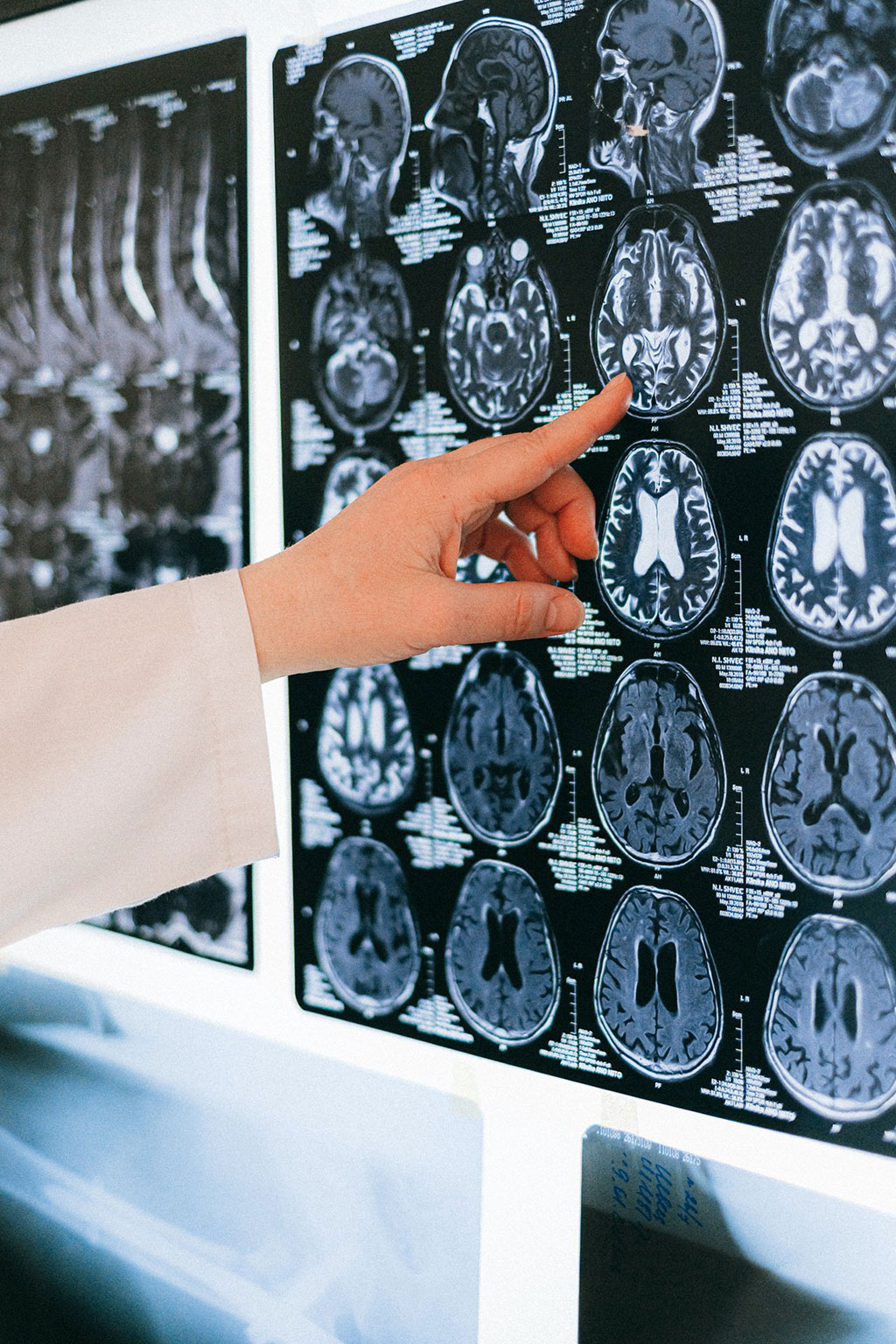 Image: Algorithm detects Alzheimer’s disease from MRI images (Photo courtesy of KTU)