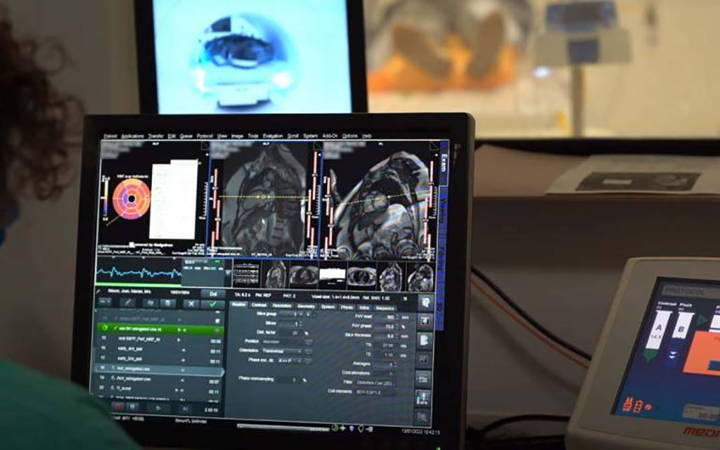 Image: Superhuman 20 second AI heart tool to begin roll-out (Photo courtesy of University College London)